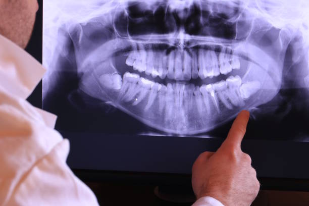 Best Emergency Dental Surgery in Atkins, VA